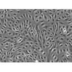 Human Coronary Artery Endothelial Cells (HCAECs)